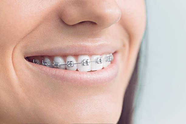TMJ/TMD Treatment in Rancho San Diego, CA